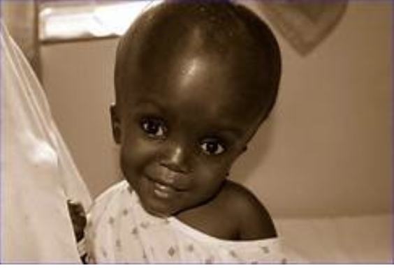 <p><span>How would you document the condition this child has?</span></p><p></p>