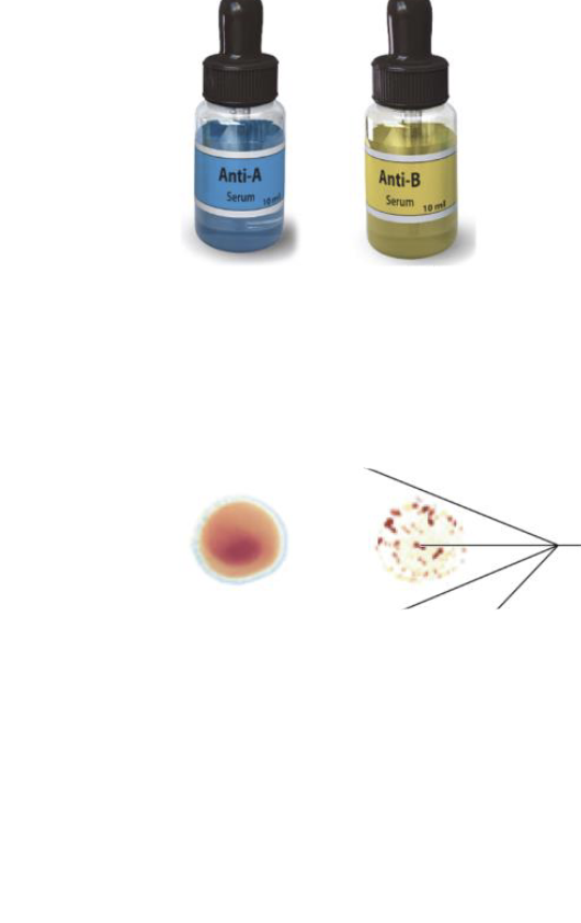 <p>Name the blood type</p>