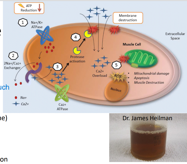 <p>Rhabdomyolysis</p>
