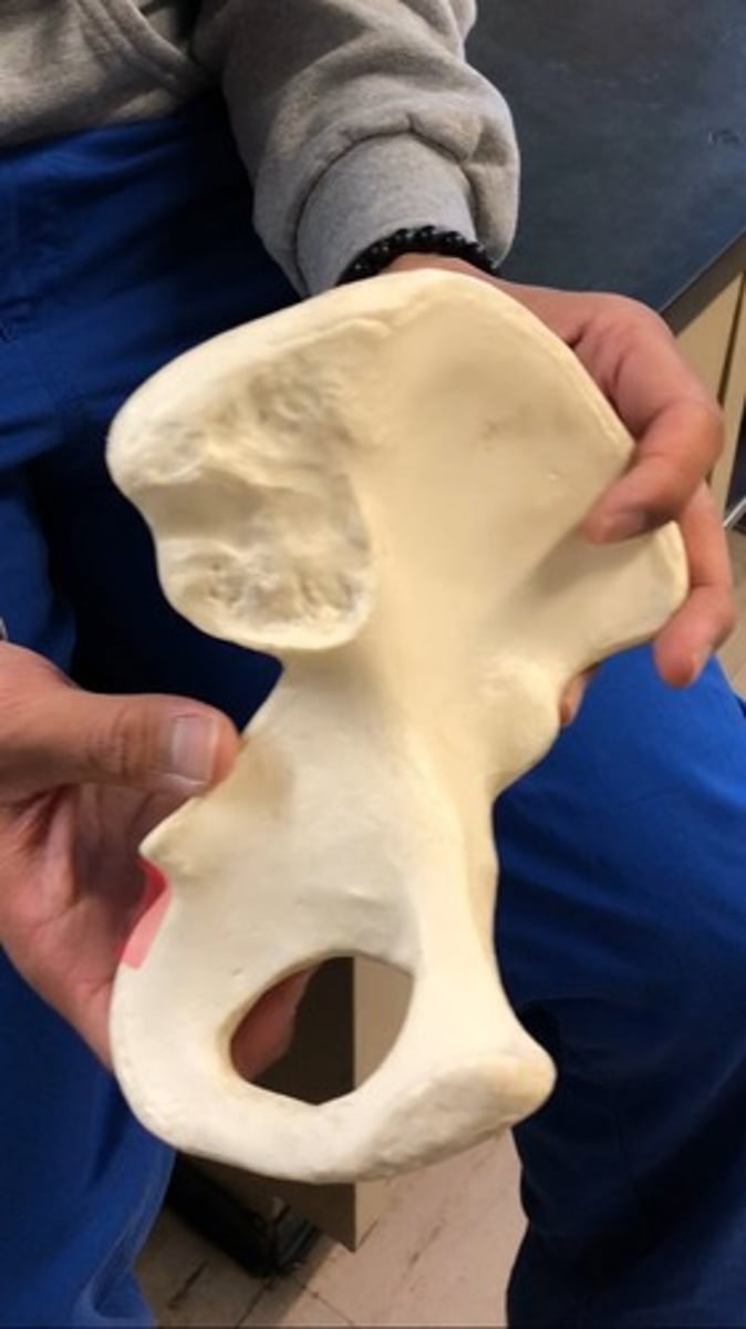 <p>depression/indent after ischial spine</p>