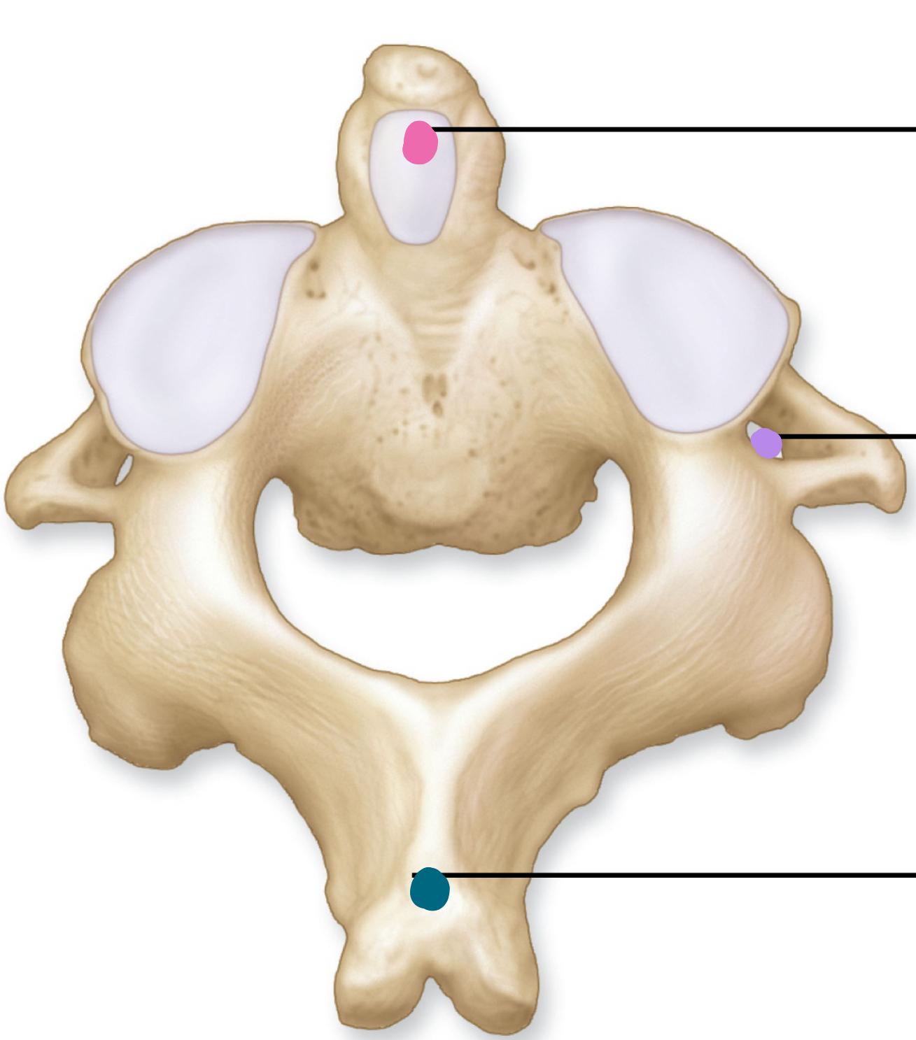 <p>What is the purple hole?</p>