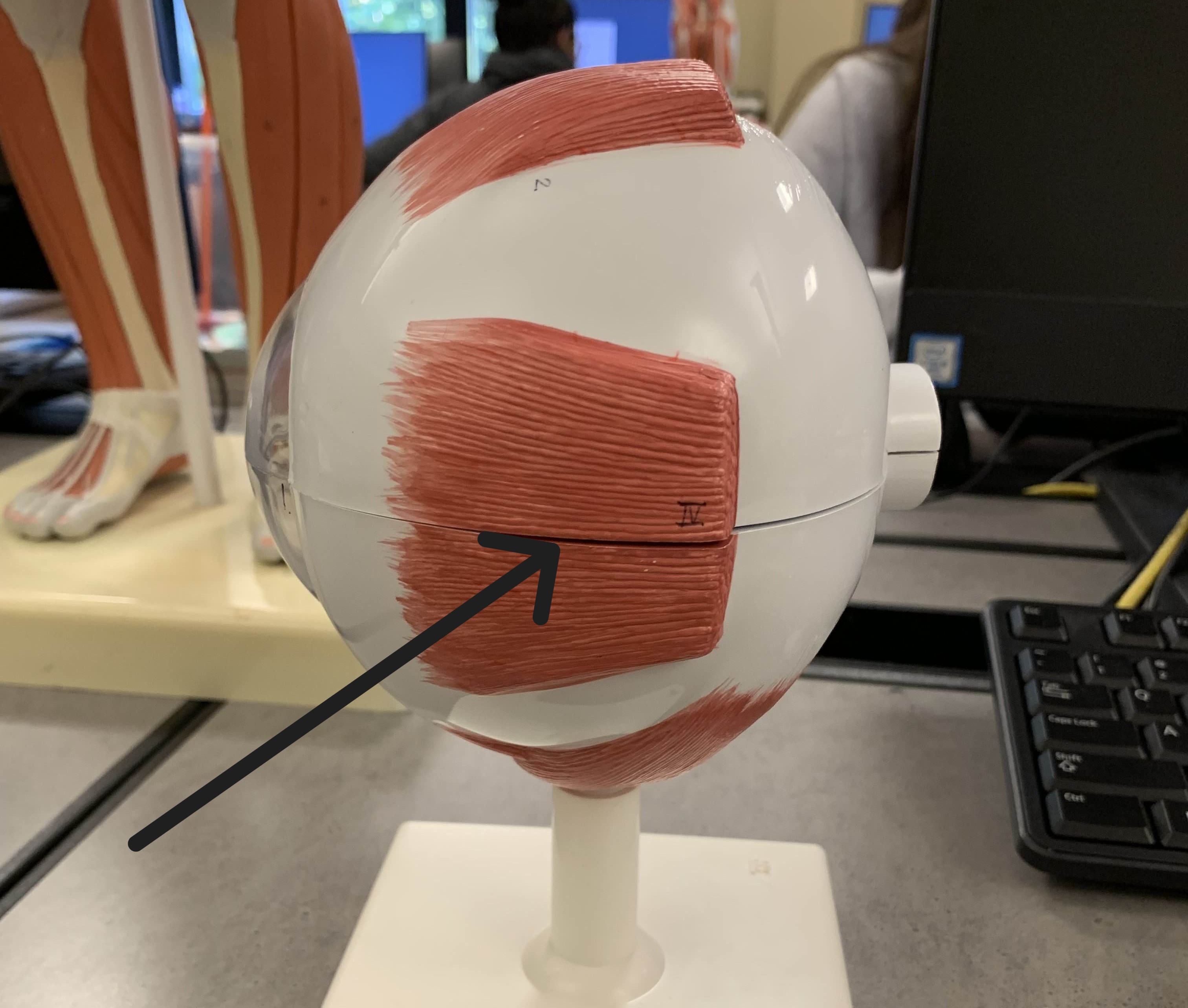 <p>Which muscle of the eye is:</p><ul><li><p>Located lateral to the pupil</p></li><li><p>Action: eye looks lateral</p></li><li><p>Nerve: <span style="color: yellow;">CN VI</span></p></li></ul><p></p>