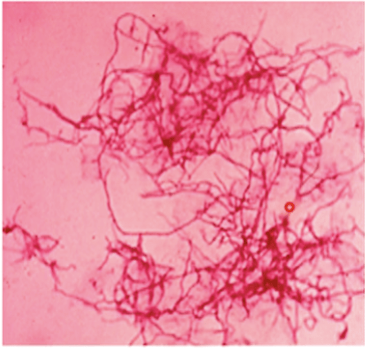 <p>- branching filaments that fragment into rods and cocci</p><p>- partially acid fast </p><p>- obligate aerobes, grow well on blood agar</p><p>- saprophytes</p><p>- cause opportunistic infections</p>