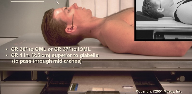 <p>What position is this?</p>