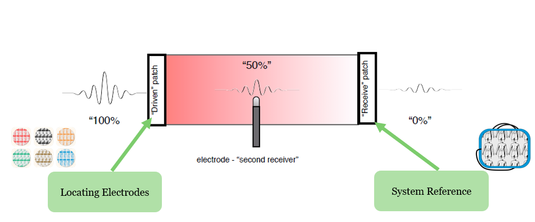 <p>Place 6 locating electrodes on patient, 3 sets at 180 degrees from each other.</p><p>*Current from Ensite X Amplifier → locating electrodes → current travels through body → system reference patch as primary receiver (ground), electrode as secondary receiver (picks up on local impedance changes in response to current)</p><p></p><p>We generate current and set baseline impedance when we VALIDATE the system - bioimpedance scaling, accounting for patient weight and patch placement</p><p></p>