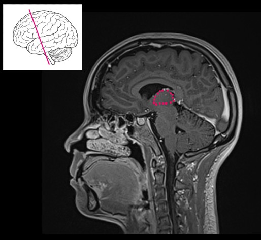 <p>Olfactory pathway.</p>