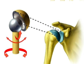 <p>name the specific type of synovial joint </p>