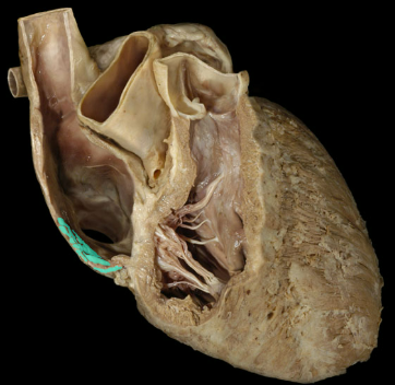 <p>Pectinate muscles</p>