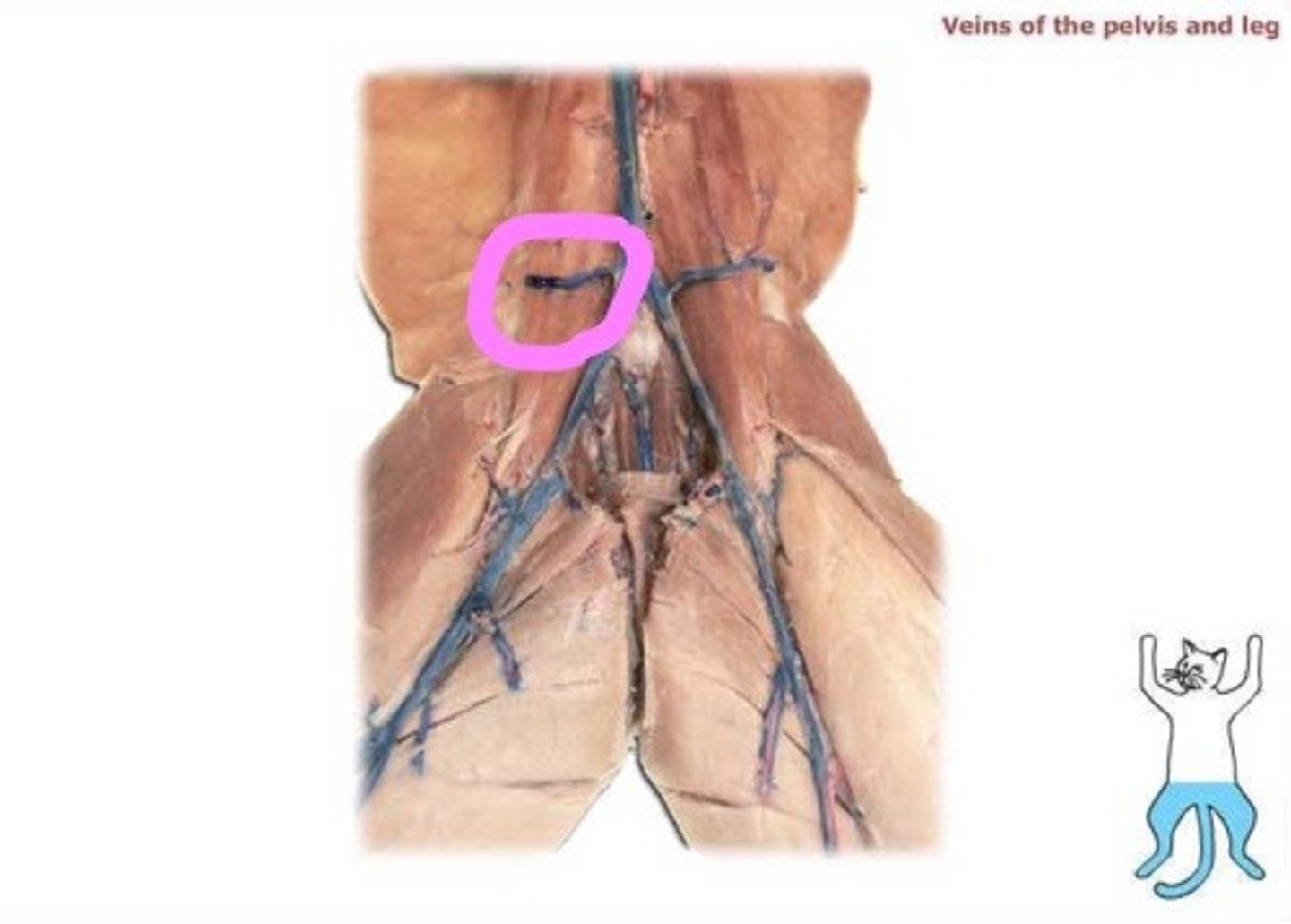<p>fairly large arteries supplying the lower back</p>