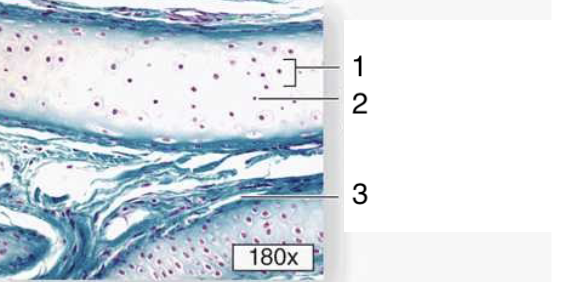 <p>What type of cartilage is this?</p>