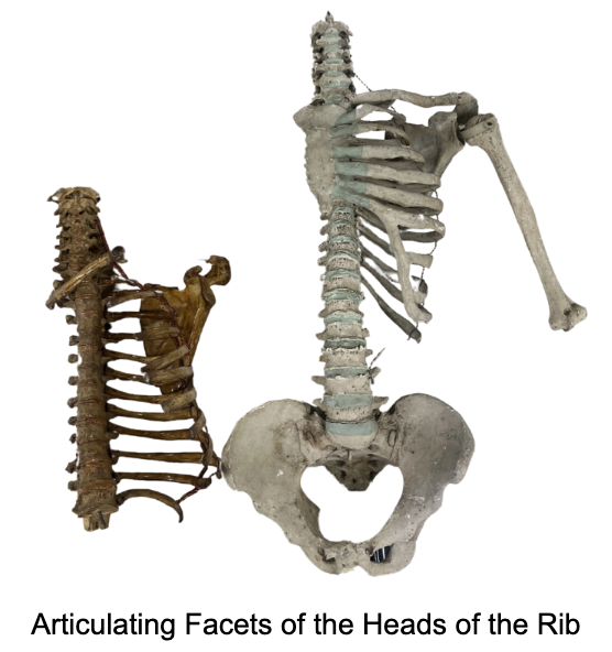 <p>The Inferior Articulating Facet of the Head of a rib articulates with the:</p><p>A. Superior Costal facet of the Thoracic Vertebra</p><p>B. Inferior Costal facet of the Thoracic Vertebra</p>