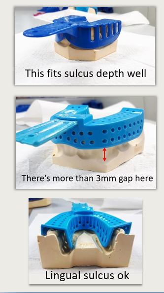 <ul><li><p>it is comfortable for the patient</p></li><li><p>contacts teeth occlusally on both sides</p></li><li><p>covers teeth and soft tissues leaving 2-3 mm gap from sulcus depth</p></li><li><p>allows slight movement side-to-side - (alginate should be minimum 2-3 mm thick to minimise tearing )</p></li></ul><p></p>