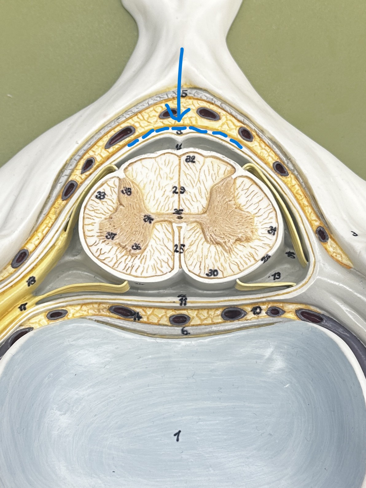 term image