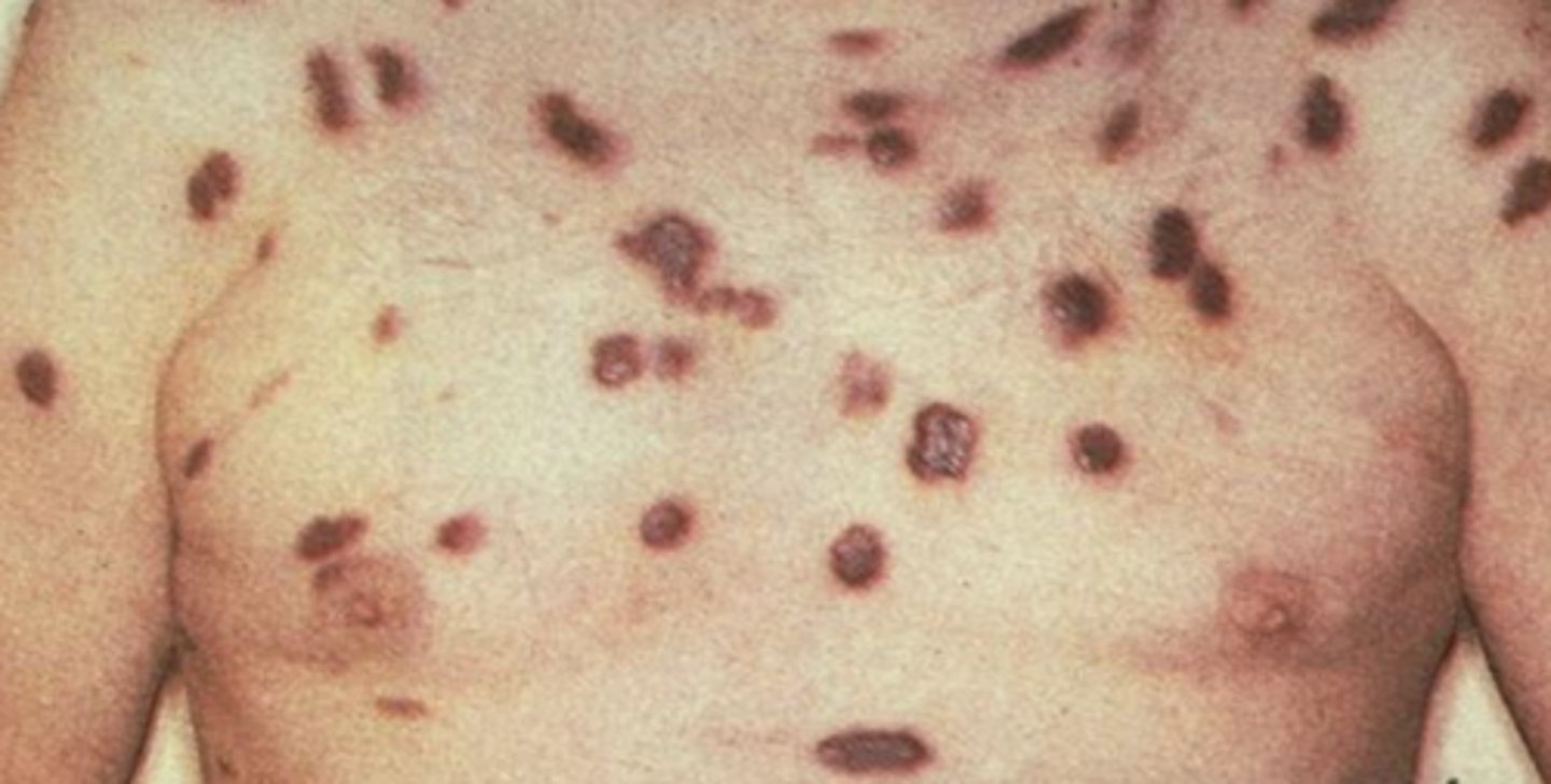 <p>What is the diagnosis?</p>