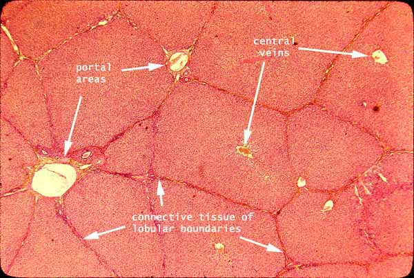 <p>Histology of a Liver</p>