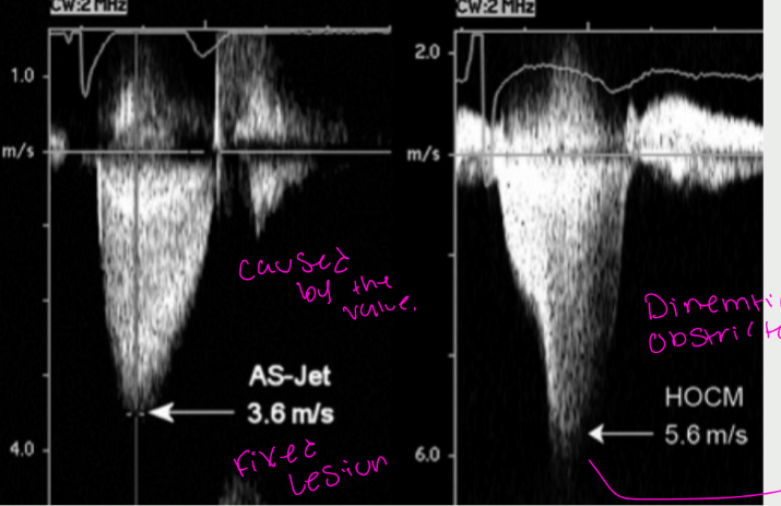 <p>what is this showing</p>