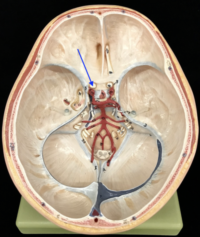 <p>What is the cranial nerve and roman numeral?</p>