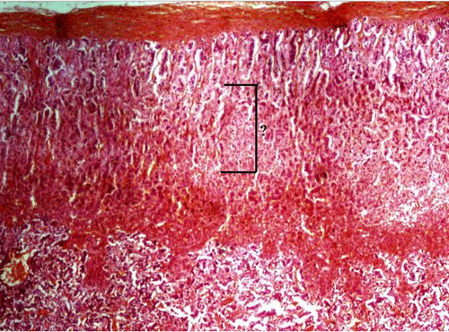 <p>Identify the indicated layer of the adrenal gland.</p>
