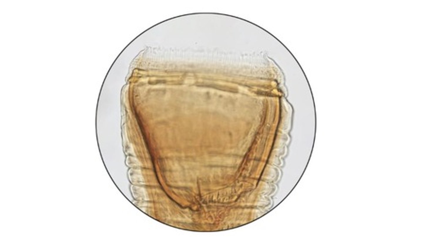 <p>Large equine strongyle that has no teeth</p><p>-Ovoid buccal cavity with external & internal leaf-crowns</p>