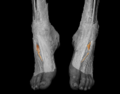 <p>origin: calcaneus, inferior extensor retinaculum </p><p></p><p>insertion: proximal phalanx of big toe </p><p></p><p>action: extend big toe </p><p></p><p>innervation: deep fibular </p>
