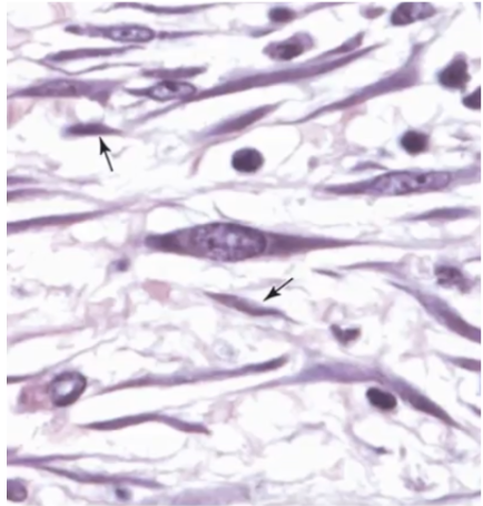 <p>What cell is inactive?</p><p>a. pointed by arrow    b. circular</p>