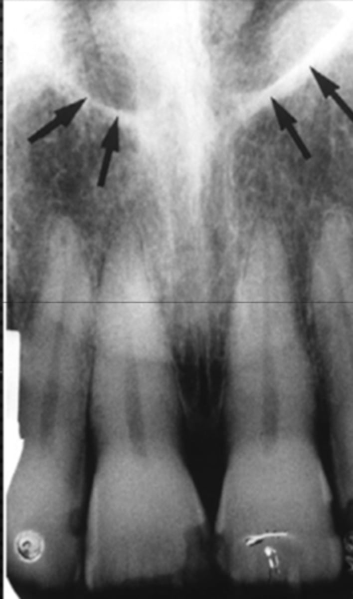 <p>Identify the structure</p>