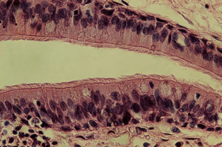 <p>Células epiteliales cilíndricas con cilios asociadas en el epitelio </p>