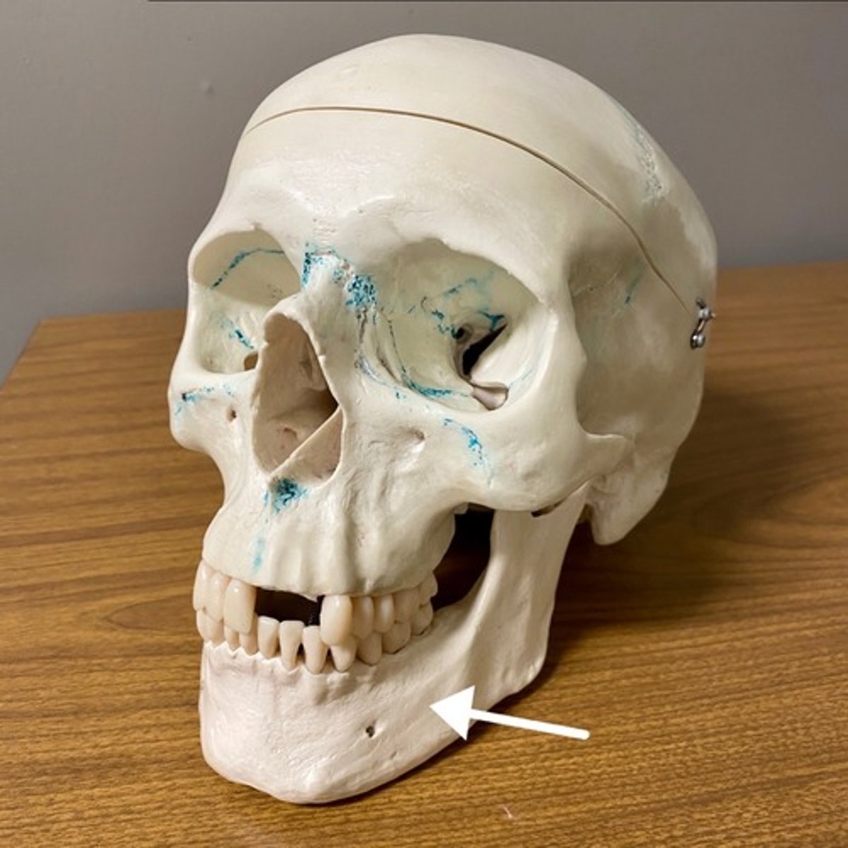 <p>What bone is this?</p>