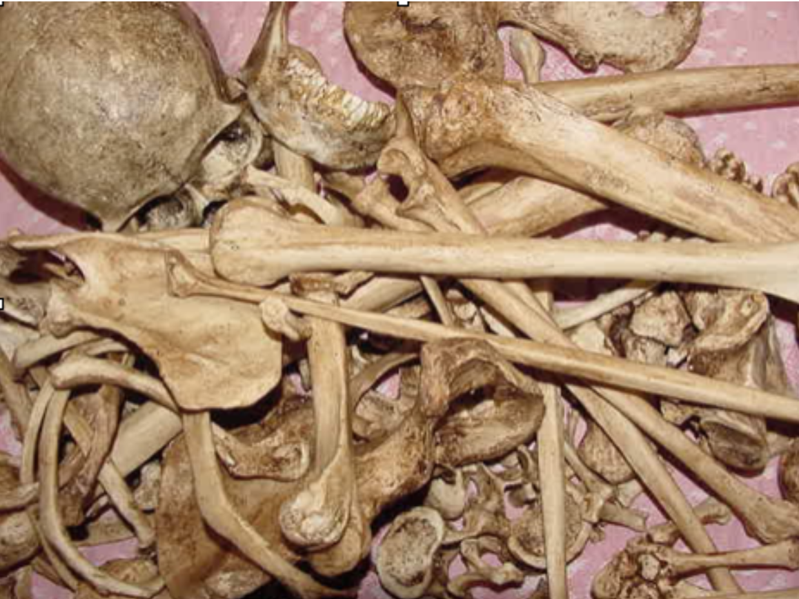 <p><span>What techniques might you use to separate commingled bones?</span></p>