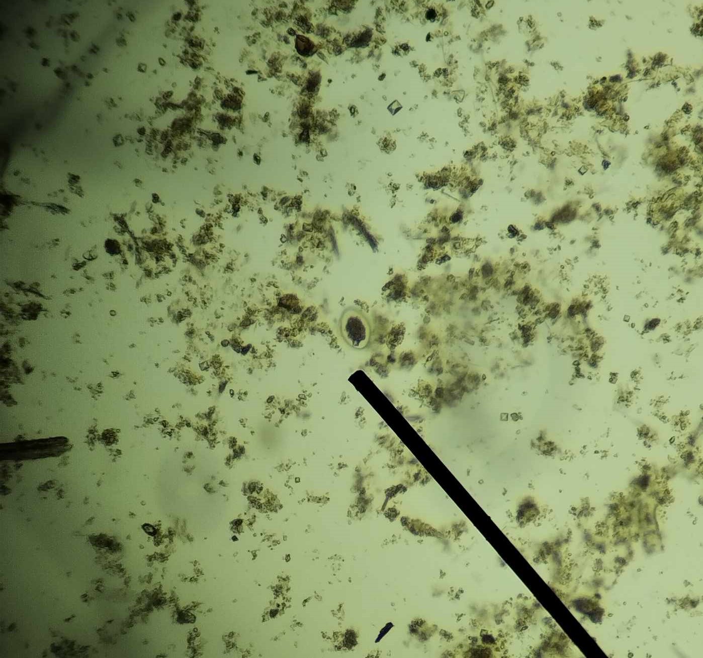 <p>Egg of which parasite?</p>