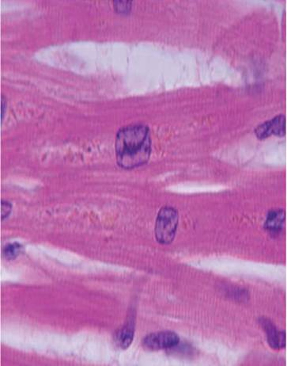 <p>striated, Y-shaped, involuntary, 1 or two nuclei, intercalated discs</p>