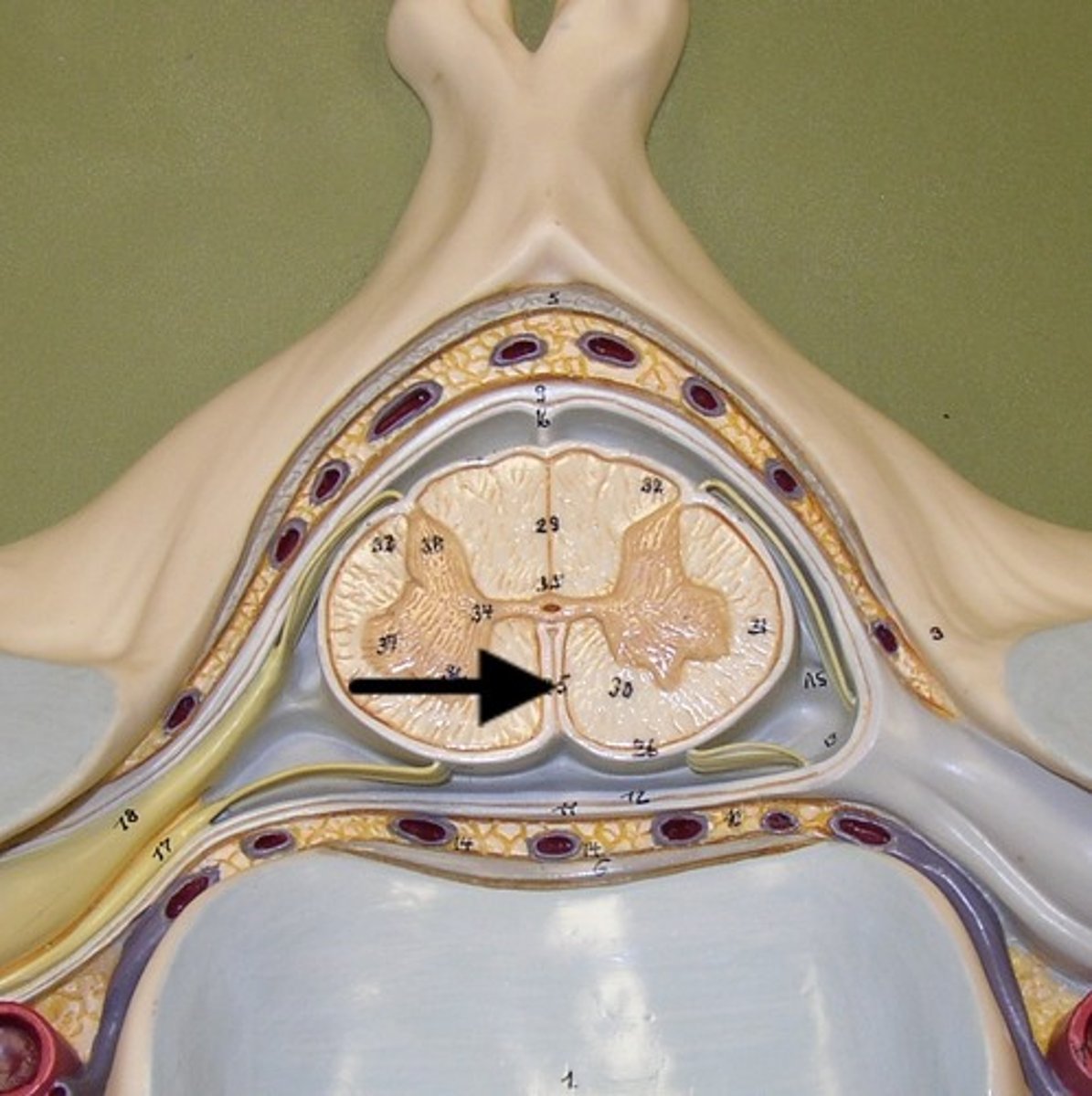 <p>Deep groove on ventral side of spinal cord. (DAM fissure - Deep Anterior Median fissure)</p>