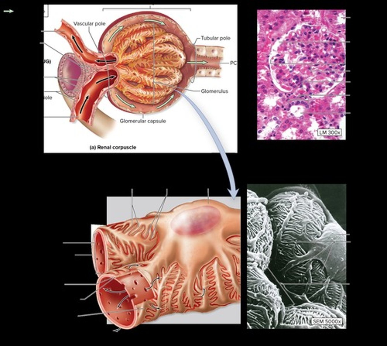 <p>Renal corpuscle and renal tubule.</p>