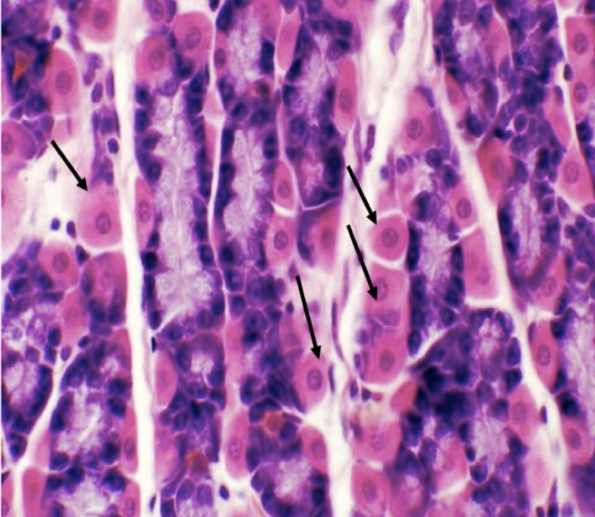 <p>Parietal/ Oxyntic Cell</p>