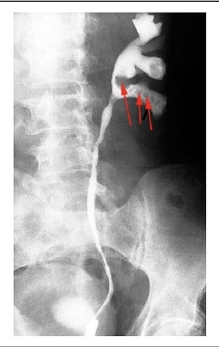 <p>What procedure?</p>