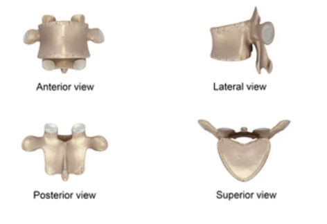 <p>Which spinal bone is this?</p>