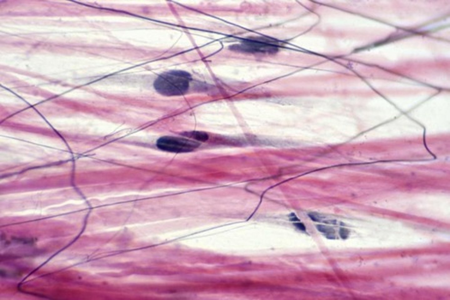 <p>It is the main structural collagen in hyaline and elastic cartilage, composed of thin fibrils arranged in a meshwork.</p>