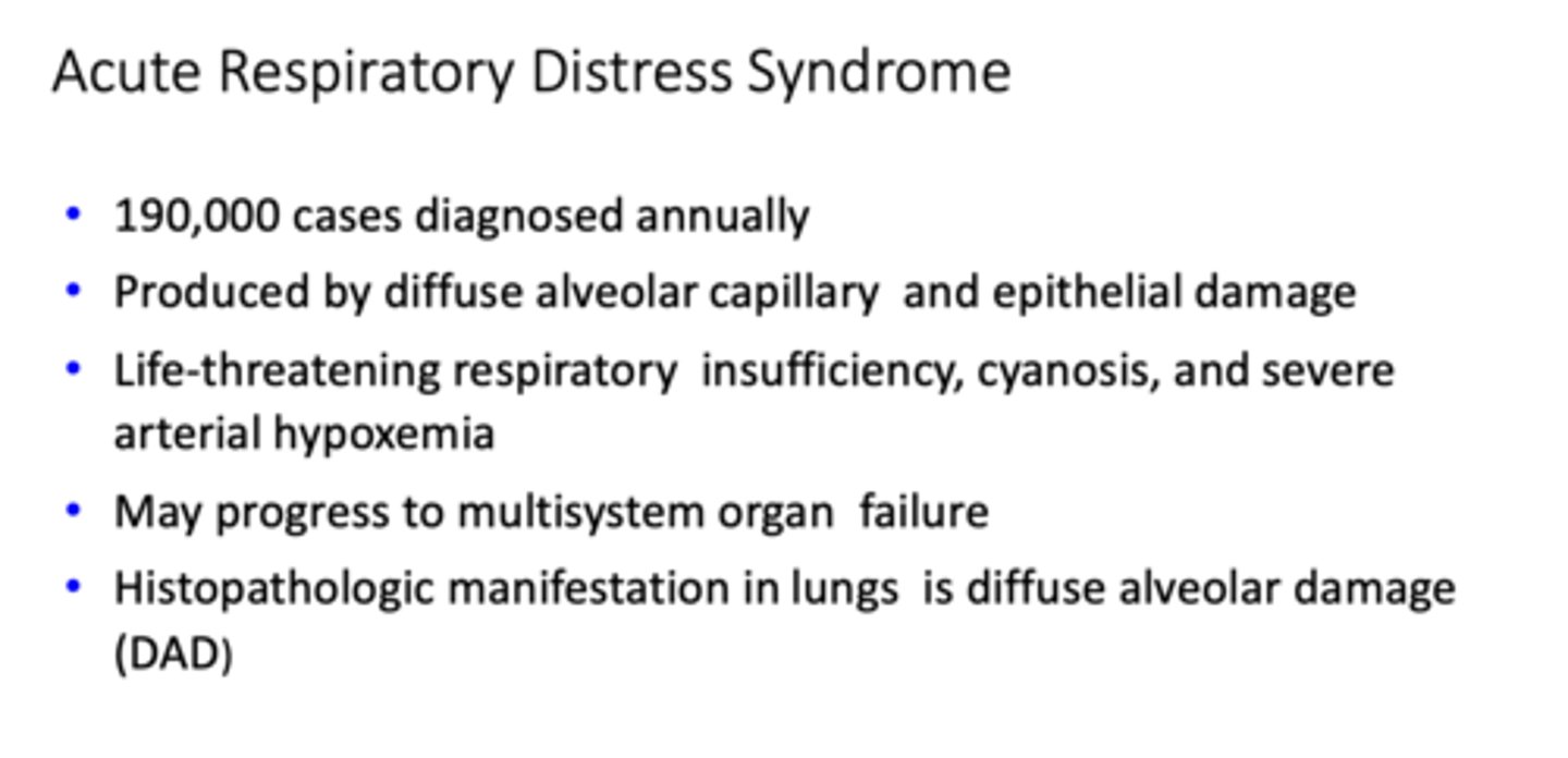 <p>Acute respiratory distress syndrome</p>