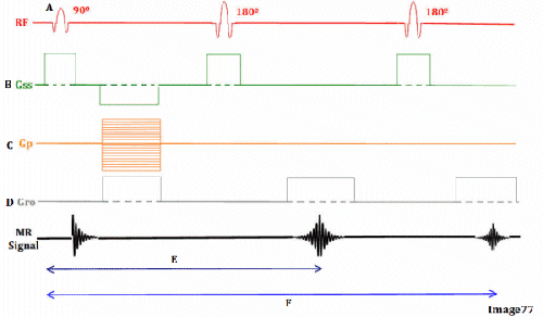 <p><span><strong>Letter F in Image 77 represents:</strong></span></p>