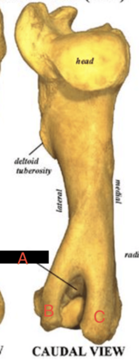 <p>What structure is labeled as B?</p>