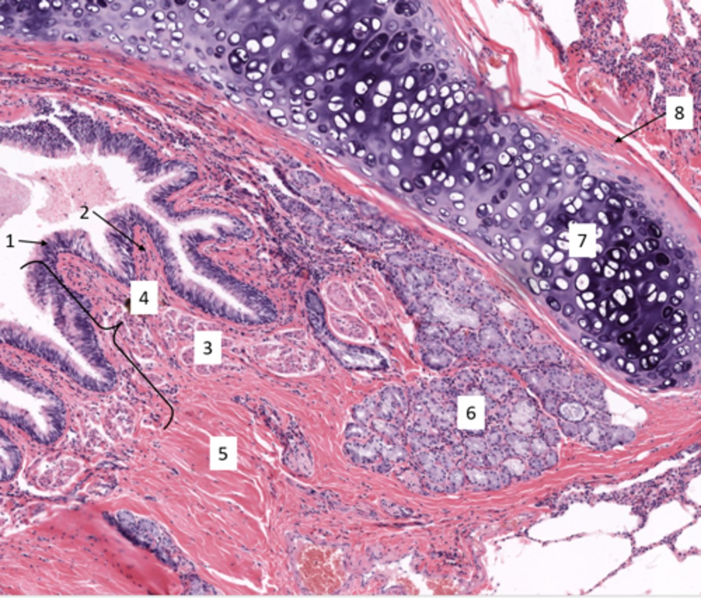 <p>Identify the layer of the respiratory tract at 4</p>