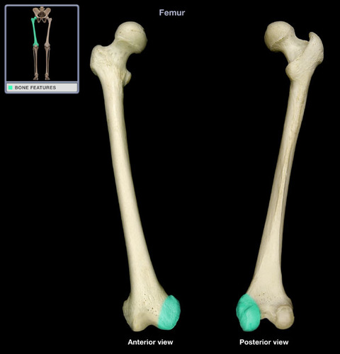 label the features of the anterior surface and posterior surface of the left femur:
__________ ___________
