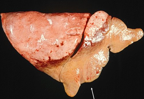<p>Describe the lesion.</p>