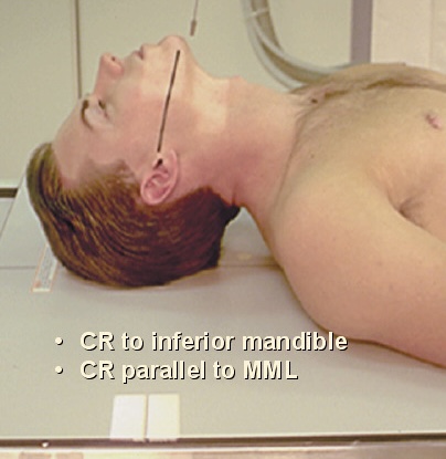 <p>What position is this?</p>