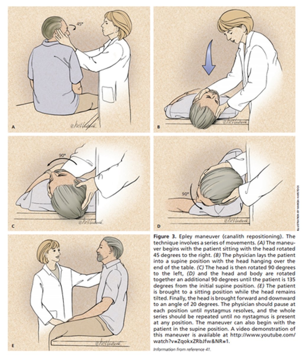 <p>BPPV</p><p>- crystalline deposits (canaliths) in the semicircular canals that disrupt the flow of fluid in the vestibular system</p><p>- canalith repositioning maneuver (Epley maneuver)</p>