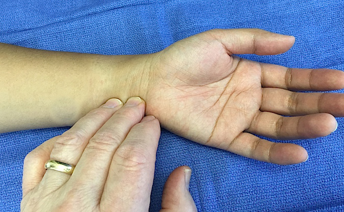 <ul><li><p>pinky side of wrist</p></li></ul><p></p>
