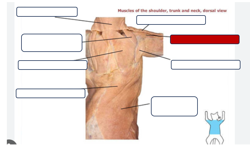 <p>Label the muscle</p>