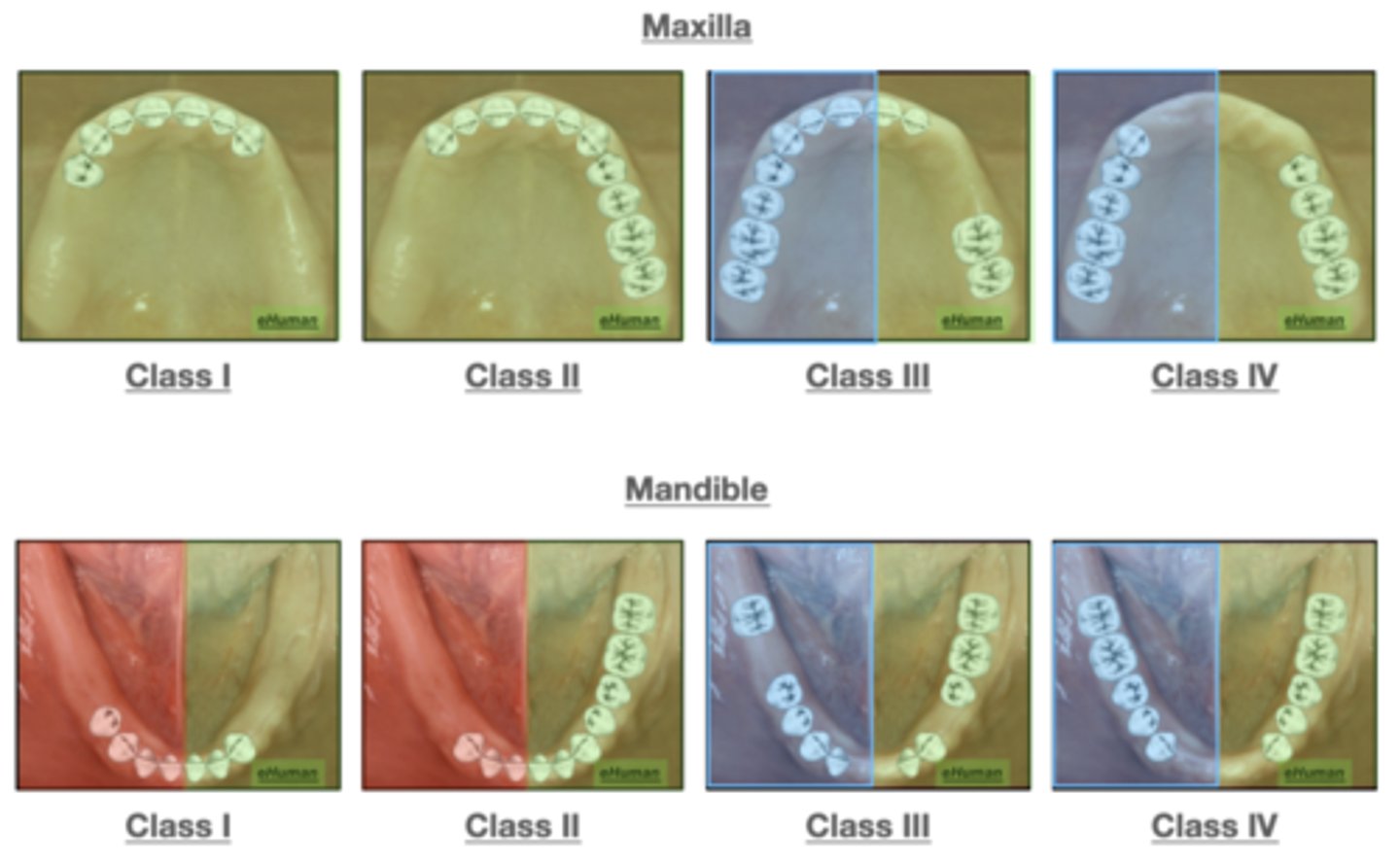 <p>What final impression technique is used for the<strong> green</strong> colored images?</p>