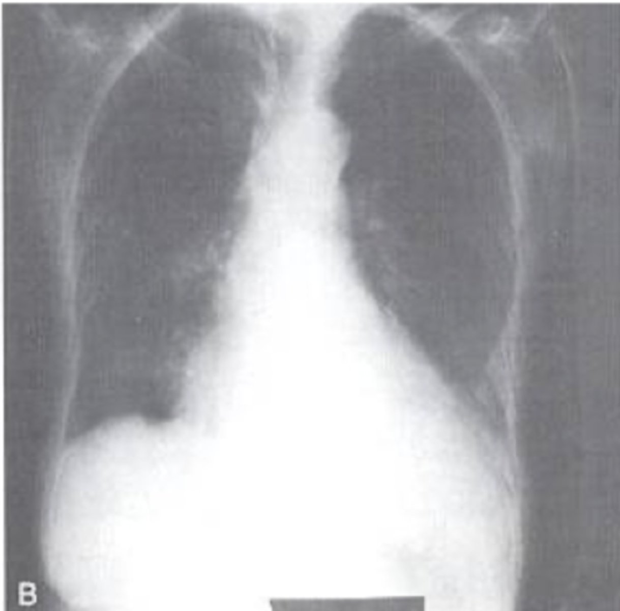 <p>What view does this show?</p>