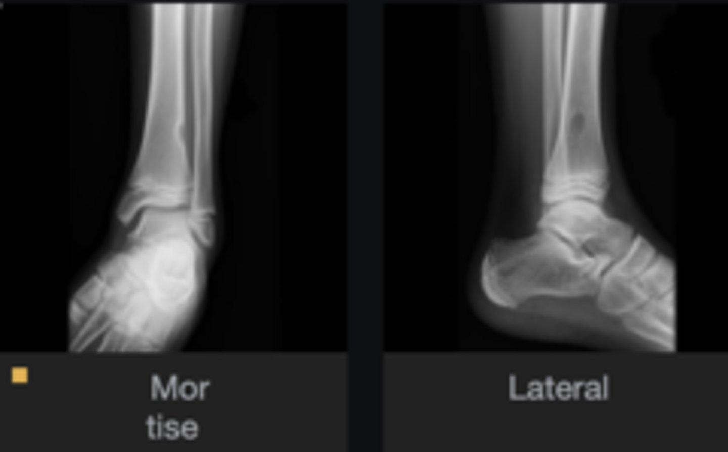 <p>Diagnosis?</p>